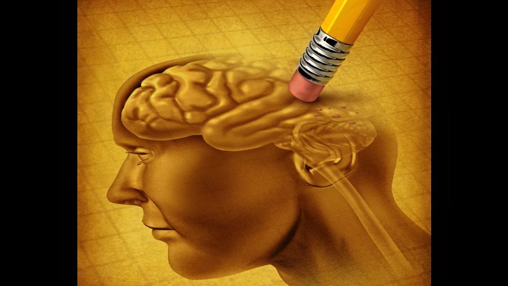 Alzheimer Factores Emocionales