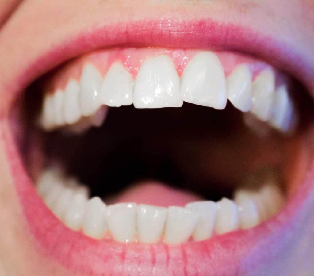 Dental decoding: How your emotions impact the health of your teeth, InfoMistico.com