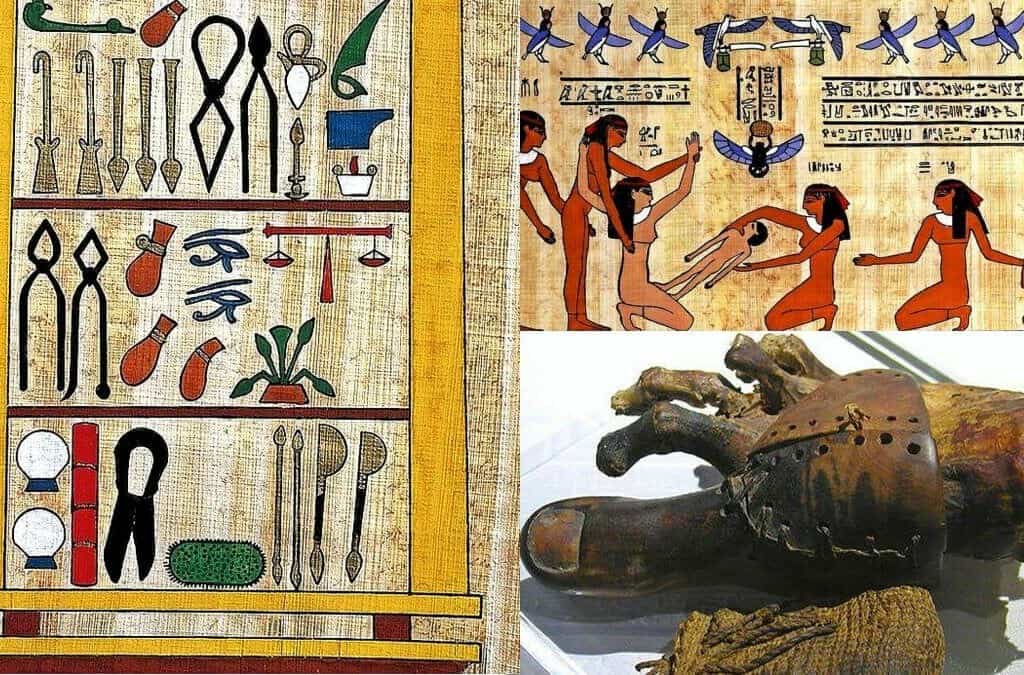 Prácticas médicas de Antiguo Egipto