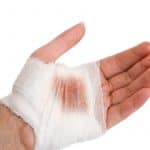 Accidents in fingers and hands from Biodecoding, InfoMistico.com