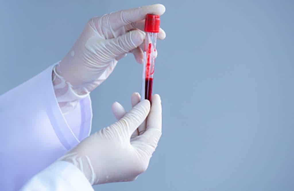 Personas con éste tipo de sangre son más vulnerables al Coronavirus, InfoMistico.com
