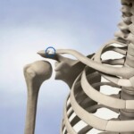 From Injuries to Liberation: The Clavicle in Biodecoding, InfoMistico.com