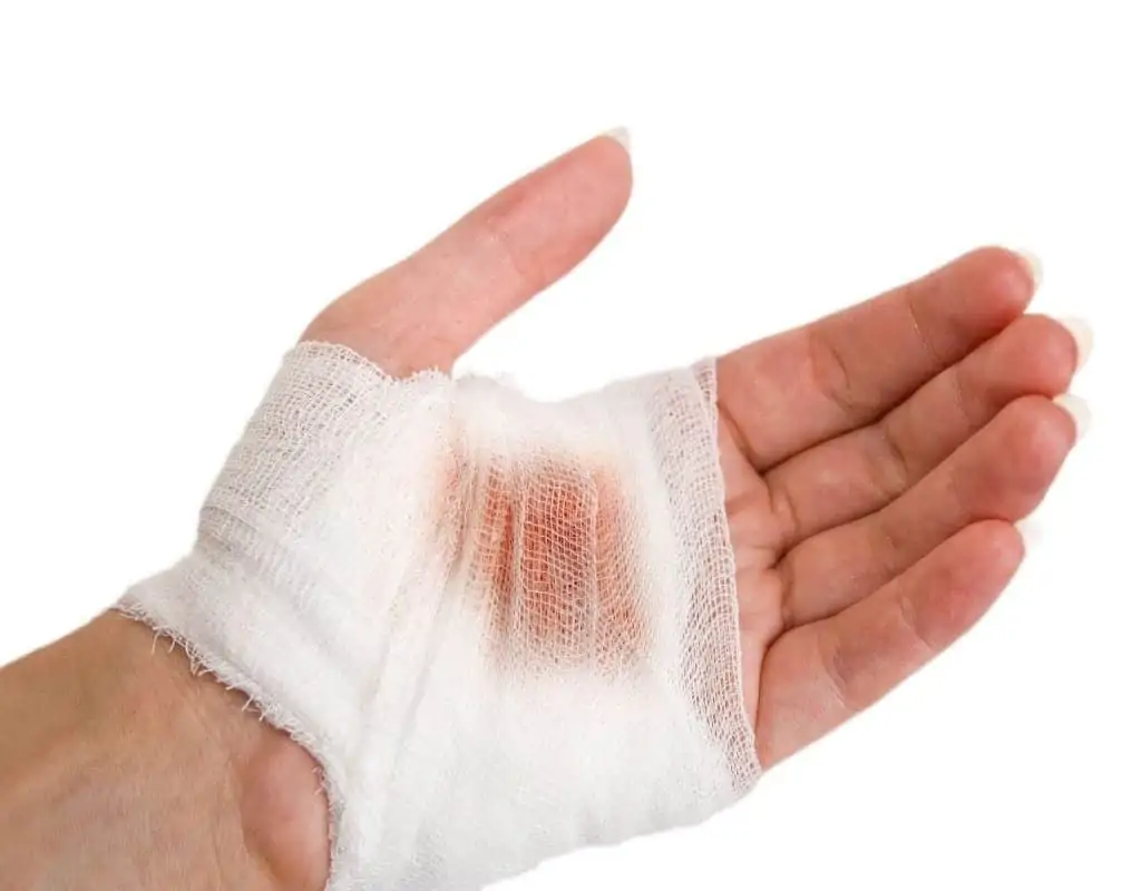 Accidentes en dedos y manos